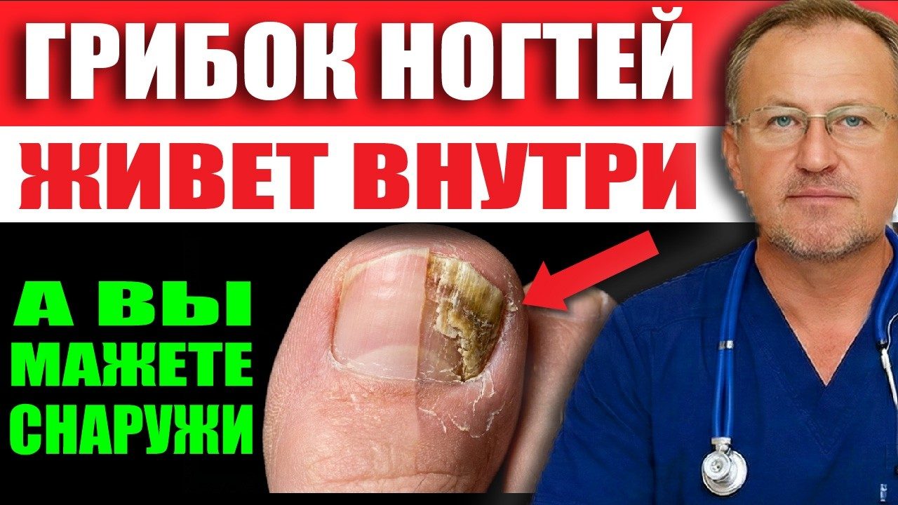 Обложка выпуска «Съешьте это, и грибку будет нечем дышать! 7 продуктов-убийц кандиды и трихофитона»